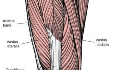 Illustration 100 for Optimal Femoral Approaches: Mastering the Lateral Intermuscular Septum