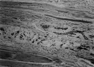 Illustration 106 for Right Shoulder Pain? Avoid This Common X-ray Mistake.