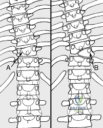 Operative Management of Hallux Valgus: Pathoanatomy, Biomechanics, and Surgical Reconstruction