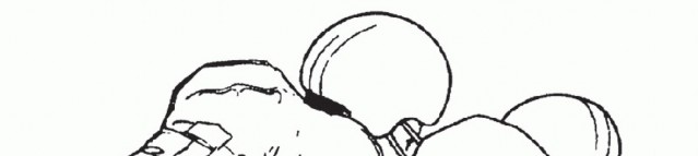 Illustration 5 for Restore Your Foot: Surgical Treatment for Hallux MP Joint Turf Toe