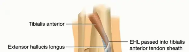 صورة توضيحية لـ تمزق وتر الظنبوبية الأمامية: دليل شامل للمرضى لتعافي تام وحياة بلا قيود مع الأستاذ الدكتور محمد هطيف