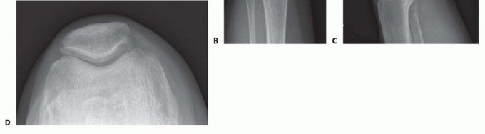 وصف طبي دقيق للمريض