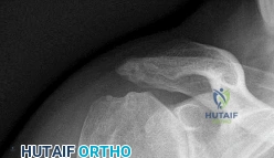 صورة توضيحية لـ دليل المرضى الشامل: استعراض أهم حالات جراحة العظام لعام 2026 - الجزء الرابع