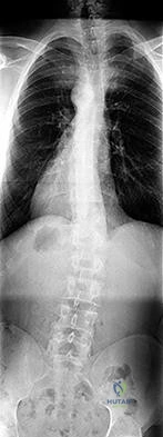 صورة توضيحية لـ دليل المرضى الشامل: استعراض أهم حالات جراحة العظام لعام 2026 - الجزء الرابع