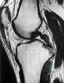 Orthopedic Surgery Mock Exam - Set B658AF
