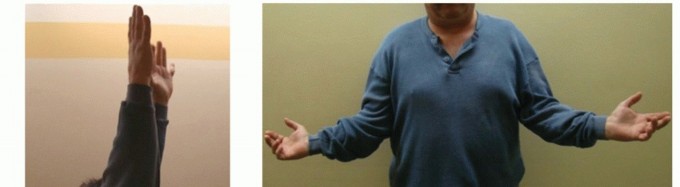 Illustration 40 for Restore Shoulder Function with Latissimus Dorsi Tendon Transfer