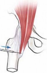 Illustration 9 for J. W. Thomas on Snapping Hip: Causes, Cures & Relief