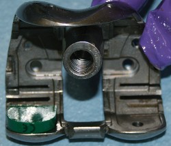 Illustration 25 for Understand Augments: The Role of Metal Augments in Arthroplasty