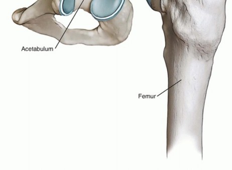 Illustration 2 for Hip Arthroscopy: Your Minimally Invasive Solution for Hip Pain