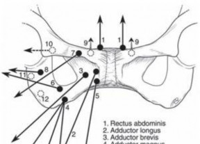 Illustration 20 for Understanding Pubalgia and Adductor Injuries: Your Guide to Relief