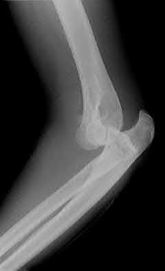 Illustration 167 for OrthoCash: Trauma MCQs & Cases for a yearold woman