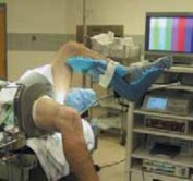 Illustration 4 for Optimizing Single-Bundle Anterior Cruciate Ligament Repair