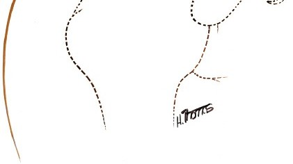 Illustration 92 for Essential Guide: Mastering Every Approach to the Shoulder