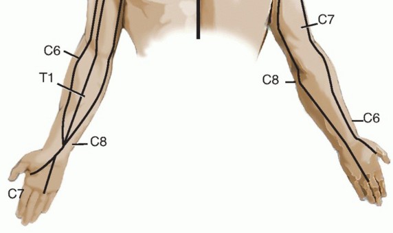 Illustration 5 for How ACDF Clears Your Posterior Disc Space for Lasting Relief