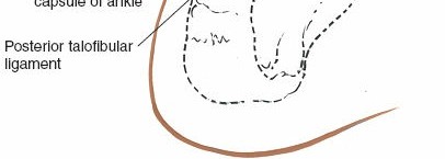 Illustration 78 for Optimized Approaches to the Dorsum of the Foot & Ankle