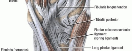Illustration 3 for Restore Your Foot: Surgical Treatment for Hallux MP Joint Turf Toe