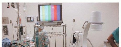 Illustration 5 for Anterior Interbody Arthrodesis for Scoliosis: What You Need to Know