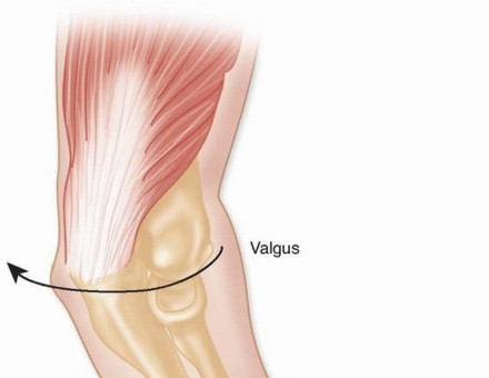 Illustration 8 for Restore Stability & Motion: Fixation of Fracture-Dislocations