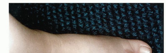 Illustration 4 for Below-Knee Amputation: Maximize Your Below-Knee Recovery & Function