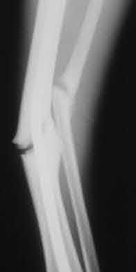 Illustration 140 for OrthoCash: Trauma MCQs & Cases for a yearold woman