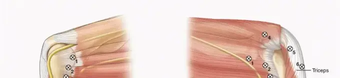 منظار الكوع والرسغ: دليل شامل للمرضى نحو الشفاء مع الأستاذ الدكتور محمد هطيف