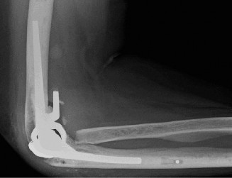 Illustration 113 for Acad Orthop Surg Challenge: Diagnose Shoulder Pain Case 1