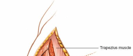 Illustration 109 for Essential Guide: Mastering Every Approach to the Shoulder
