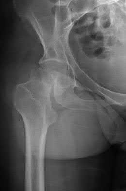 Illustration 17 for OrthoCash: Trauma MCQs & Cases for a yearold woman