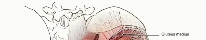 استبدال مفصل الورك الكلي: رحلة آمنة لتجنب المضاعفات مع الأستاذ الدكتور محمد هطيف