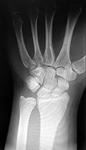 صورة طبية: دليل الأستاذ الدكتور محمد هطيف الشامل لأمراض وإصابات اليد والمعصم في صنعاء