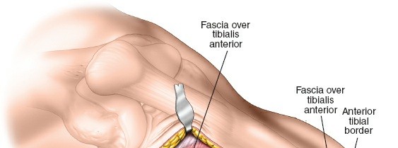 Illustration of line of the skin - Dr. Mohammed Hutaif