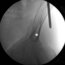 Trauma Orthopedic Review | Dr Hutaif Trauma & Fractures -...