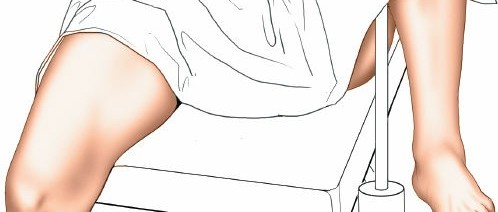 Illustration 2 for Mastering Knee Arthroscopy Approaches: Safely Withdraw the Arthroscope