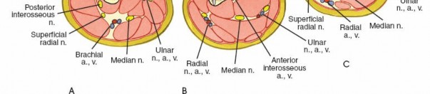 Illustration 8 for Key Approaches for External Fixation: Humerus, Radius, Ulna, Wrist