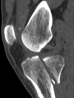 Illustration 42 for OrthoCash: Trauma MCQs & Cases for a yearold woman
