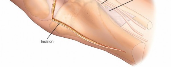 Illustration 38 for Surgical Access: Mastering the Tibia's Surface & Fibula Approaches