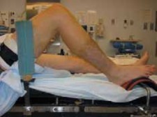 Allograft Cartilage Transplantation: Advanced Repair for Joints