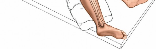 Illustration 71 for Surgical Access: Mastering the Tibia's Surface & Fibula Approaches