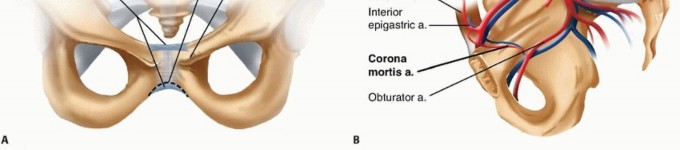 Illustration 2 for Achieve Stable Fixation of the Symphysis: Open Reduction