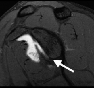 Illustration 37 for Acad Orthop Surg Challenge: Diagnose Shoulder Pain Case 1
