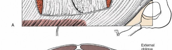 Illustration 109 for Approach to the Lumbar Spine: Mastering Techniques & Anatomy