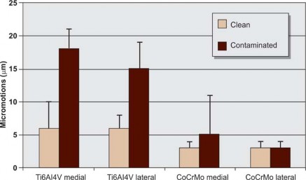 Illustration 24 for Kinectiv® Stem: Modular Necks for Primary THA Success