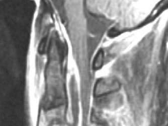 Illustration 11 for Master Orthopedic Spine Cases: Sharpen Your Diagnostic Skills