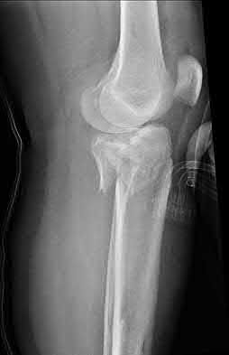 Illustration 152 for OrthoCash: Trauma MCQs & Cases for a yearold woman