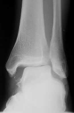 Illustration 59 for OrthoCash: Trauma MCQs & Cases for a yearold woman