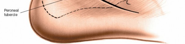 Illustration 119 for Optimized Approaches to the Dorsum of the Foot & Ankle