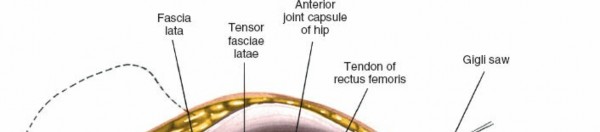 Illustration 111 for Unlocking Every Aspect of the Hip's Surgical Approaches