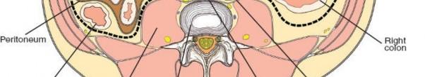 Illustration 5 for Expert Guide: Transperitoneal and Retroperitoneal Lumbar Access