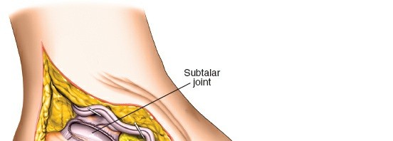 Illustration 133 for Optimized Approaches to the Dorsum of the Foot & Ankle