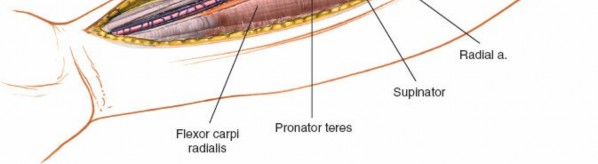 Illustration 9 for Radius Anterior Approach: Safe Nerve Protection & Complete Exposure